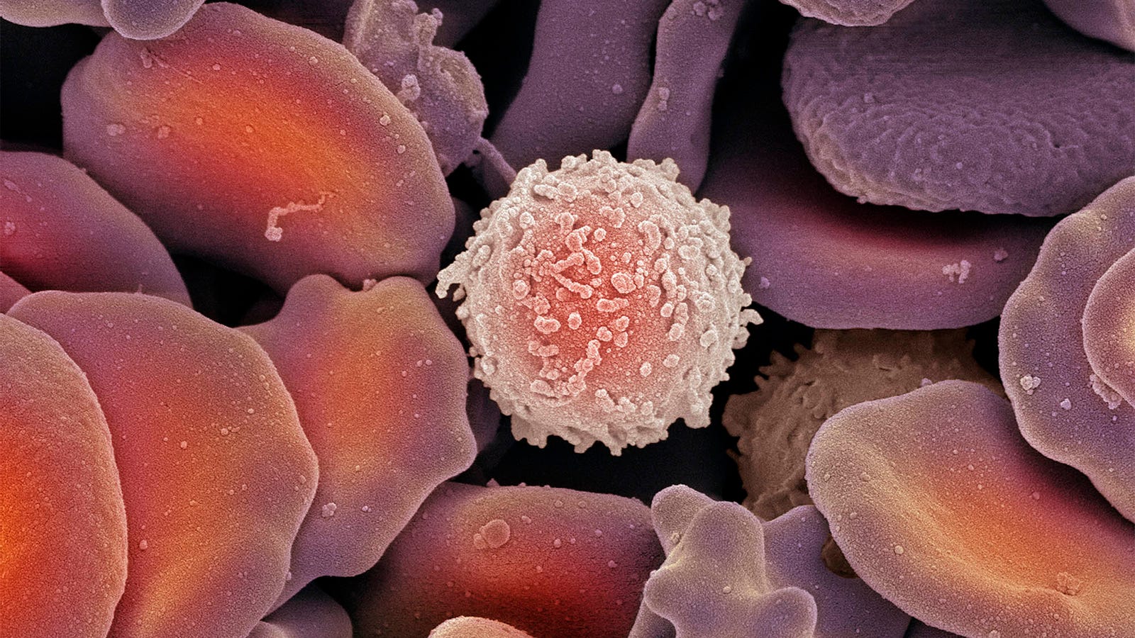 Hardened White Blood Cell No Longer Hesitates To Kill Viruses