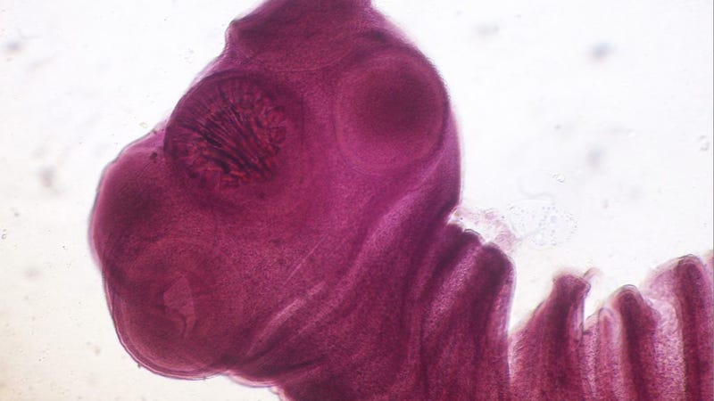 Illustration for article titled Scientists Discover a Potential Cure for 400,000 Seizure Sufferers