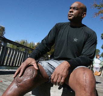 Illustration for article titled Now That's A Knee Injury!
