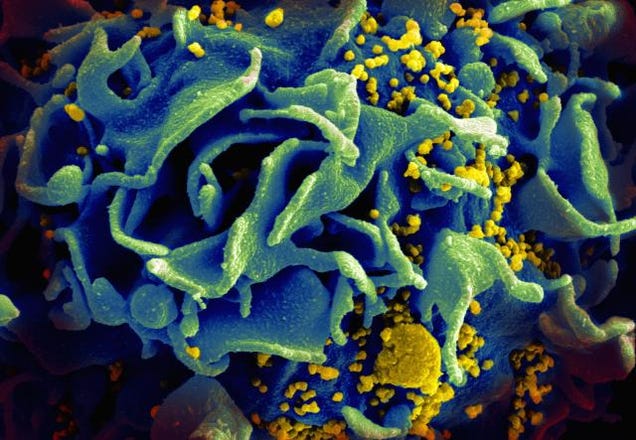 Researchers Have Identified The Origin Of The AIDS Pandemic
