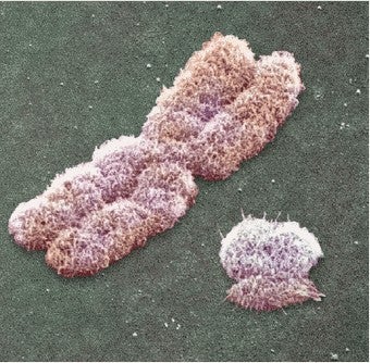 Illustration for article titled Is The Y Chromosome Dying Out?