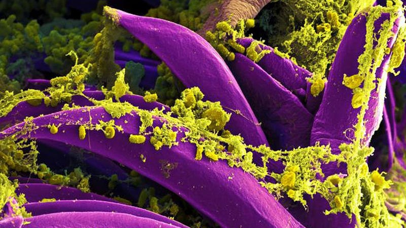A colorized scanning electron microscopic image of plague bacteria, in yellow, on a flea. 