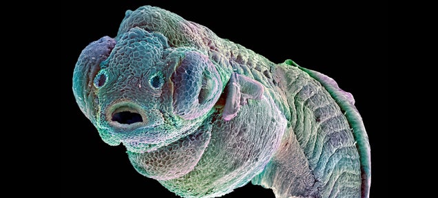 This little alien monster is fundamental to cancer research