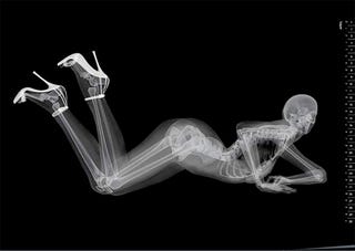 Illustration for article titled Metal Detectors Fail When "Pretty, Young Lawyers" Visit Belgian Prison