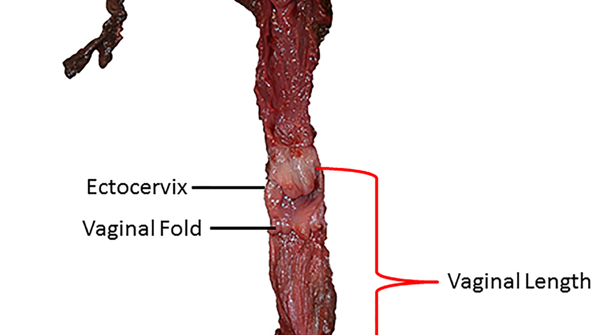 What is the length of the vagina in girls and women The maximum length of the vagina 17 What is the length of the vagina in girls and women The maximum length of the vagina 75