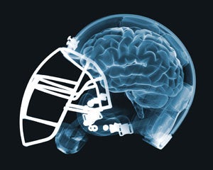 Illustration for article titled NFL Gets Brained By Its Own Study