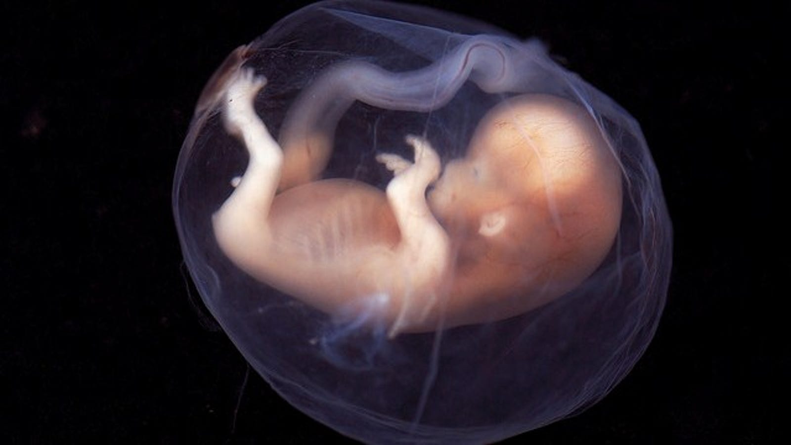 New photographs reveal that fetuses yawn in the womb