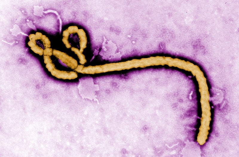photo of Clingy Ebola Virus Found Hanging Out in Man's Semen for Over a Year image