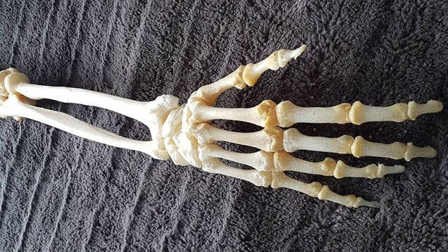 Guy Gets Severed Arm Preserved by Taxidermist: 'I Wanted to Do Something Cool'
