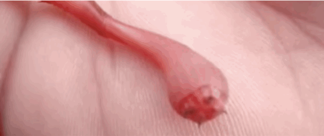 The Mouth Of A Blood Worm Is A Terrible Thing To Behold
