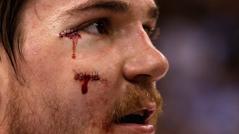 Illustration for article titled Andrew Shaw To Auction Off The Stitches From His Glorious Hockey Face