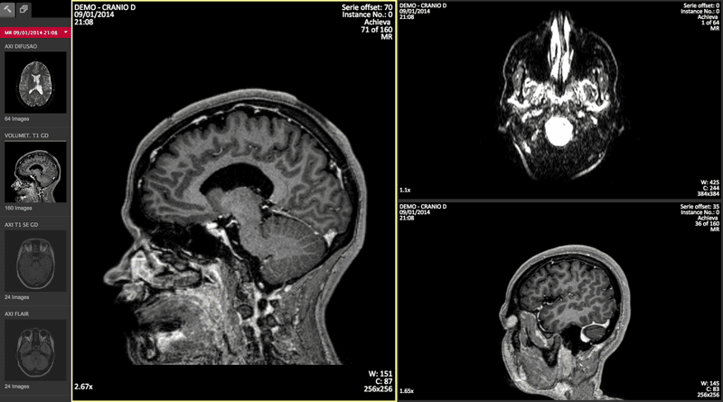 Illustration for article titled Know About the Best DICOM Viewer Available Online
