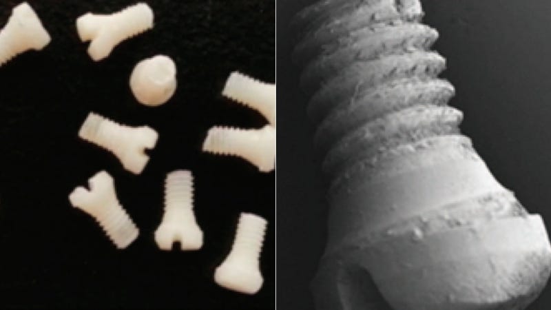Illustration for article titled Someday, Surgeons Might Fix Your Broken Bones With Screws Made of Silk