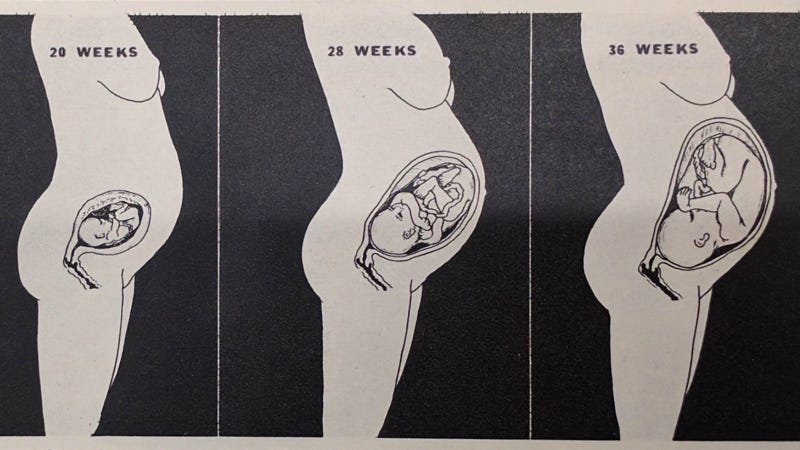 A panel from Life’s “Birth of a Baby.” New-York Historical Society.