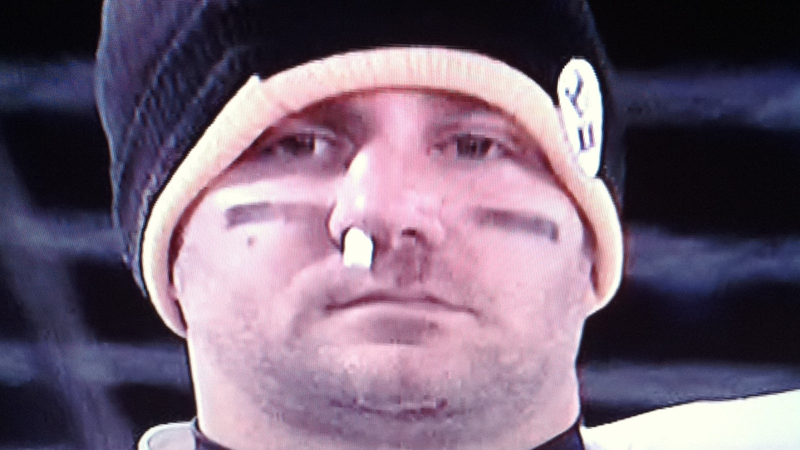 Big Ben Successfully Keeps His Brains From Leaking Out