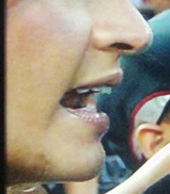 Illustration for article titled America's Sideline Chin Bruise