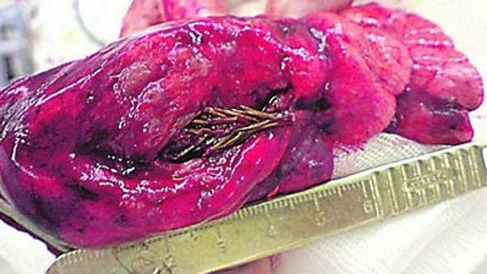 Plant growing in lung information