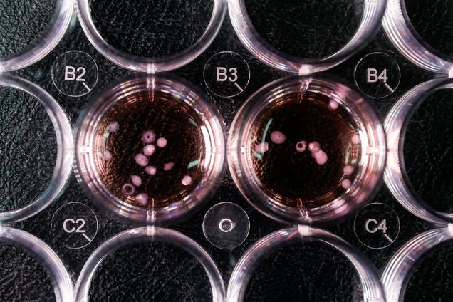 What AI mavens can learn from a 1975 genetics conference