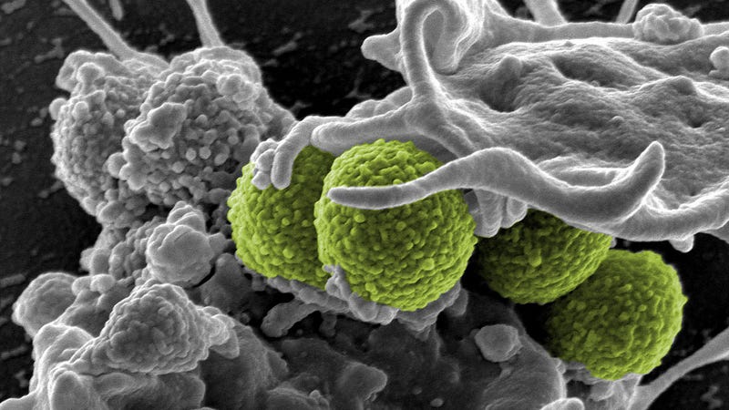 Image: NIH NIAID/Flickr