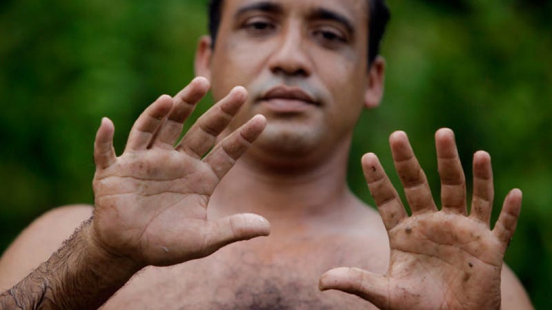 Illustration for article titled This man's hands are no optical illusion