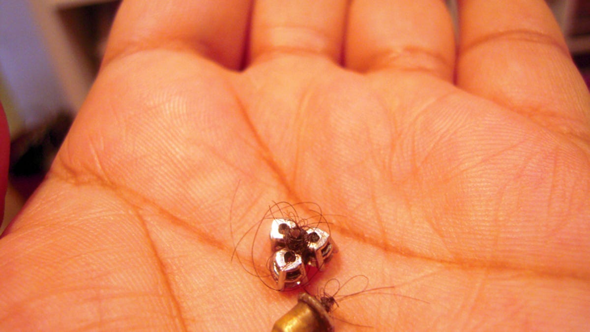 The Grossest Earring Removal Story You Ll Hear This Week