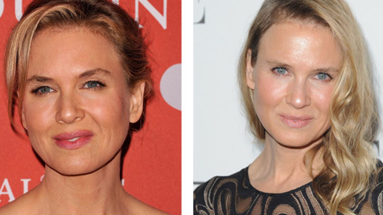 The Science Behind Renee Zellweger's New Face