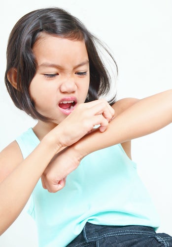 Illustration for article titled Are pain and itchiness the same thing?