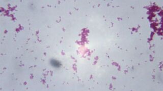 Photodisc/Thinkstock