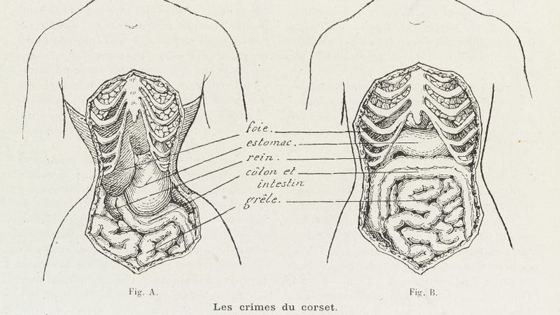 Illustration for article titled Apparently, Corsets Are Just Super Chill Rib Bras