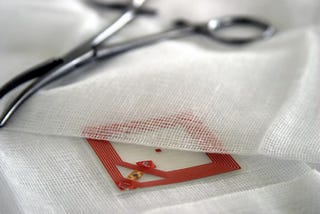 Illustration for article titled RFID Medical Sponges Help Forgetful Surgeons