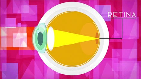 Contact Lenses That Darken in Sunlight Are Going to Give ...