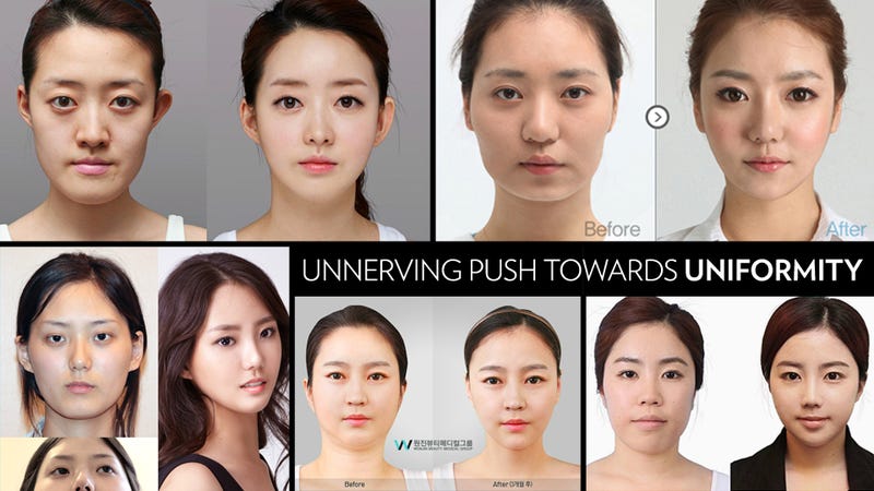 free asian plastic surgery