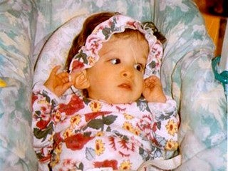 Illustration for article titled Infant-Sized Teenager May Provide Key to Reversing the Aging Process