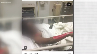 Breeja Wilkins’ family says she needed skin to be taken from her thighs in order to cover injuries all along her arms, hands and shoulders after being verbally attacked by a man and hit with his truck.