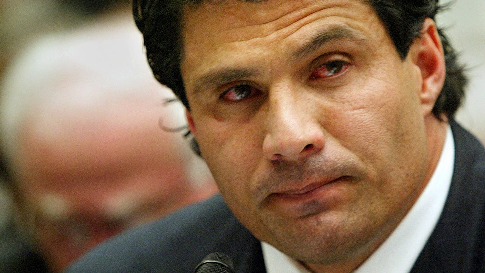 Jose Cansecos GrossAss Detached Finger Might Be For Sale