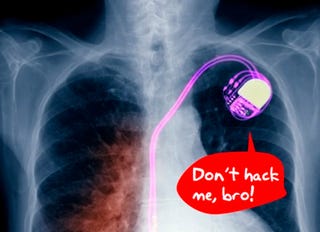 Illustration for article titled Scientists Demo Freaky New Hacking Target: Pacemakers
