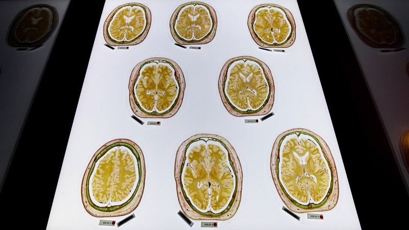 Preserved slices of a human brain for sale to institutions in Germany. (Photo: Getty)