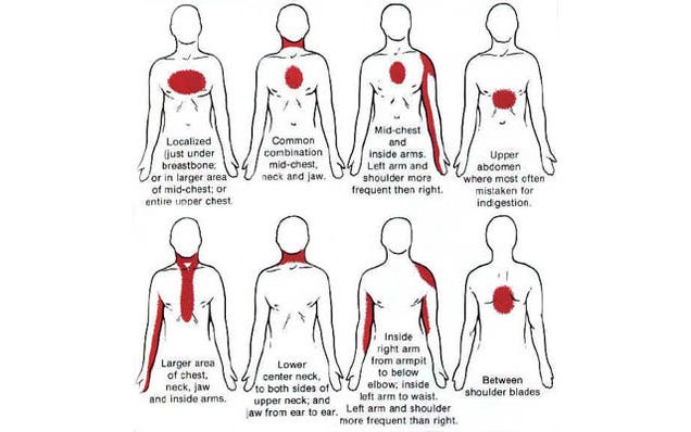  attack symptoms can be mild and have different symptoms. The signs may