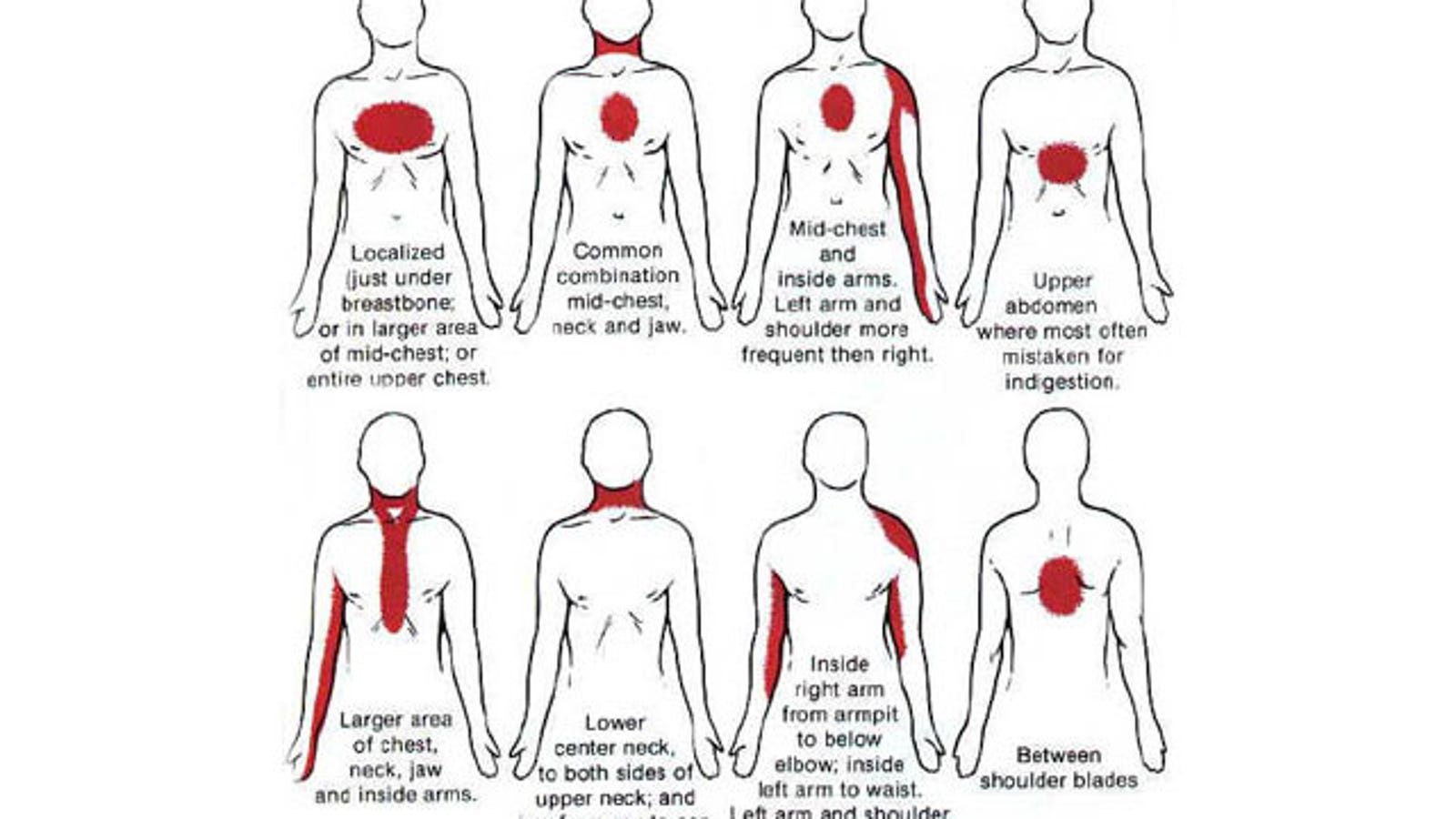 Know The Warning Signs Of A Heart Attack Theyre Different For Women