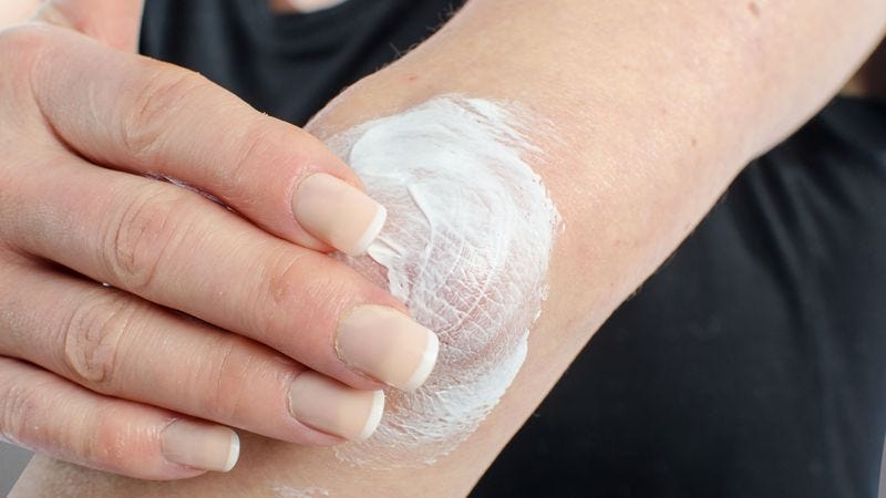 Sara Holloway applies lotion on her arm.