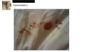 Bleeding losing virginity pic 7