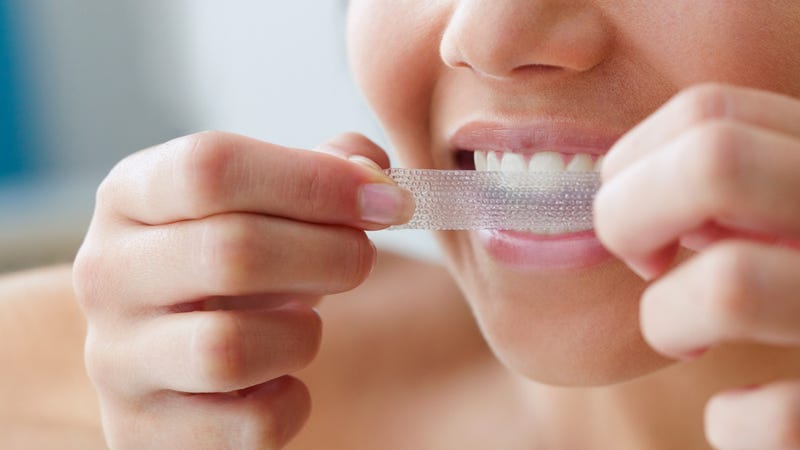 Illustration for article titled Teeth-Whitening Products Might Be Riskier Than We Thought