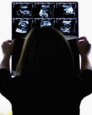 Illustration for article titled Prenatal Sex-Selection Comes To America
