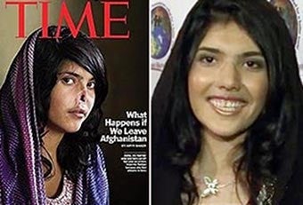 Time's Afghan Cover Girl Gets A New Nose