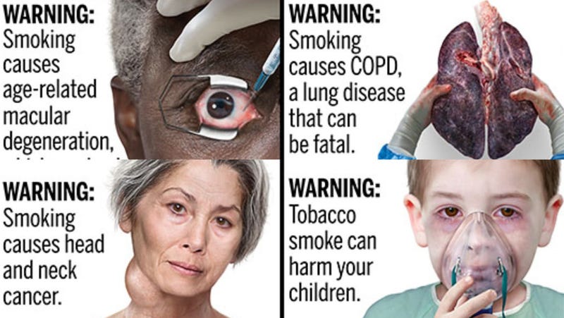 Illustration for article titled The FDA Is Previewing Some Grisly New Cigarette Warnings