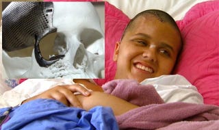 Illustration for article titled Surgeons In Brazil Successfully Implant A 3D-Printed Titanium Skull