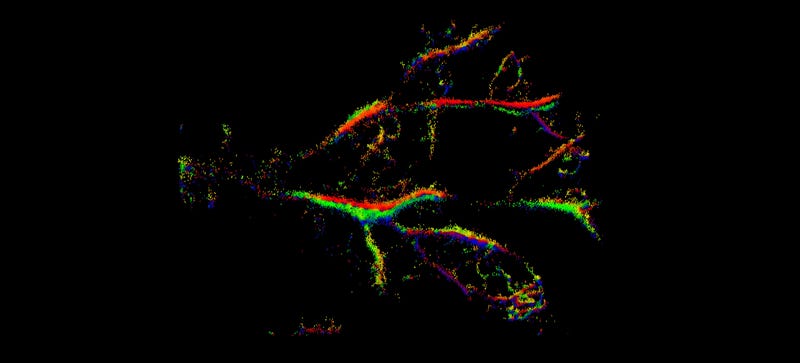 Illustration for article titled How Tiny Microbubbles Can Reveal the Hidden Structures Within Us