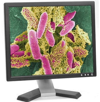 Illustration for article titled Why E.Coli Bacteria Is Better Than Your Computer