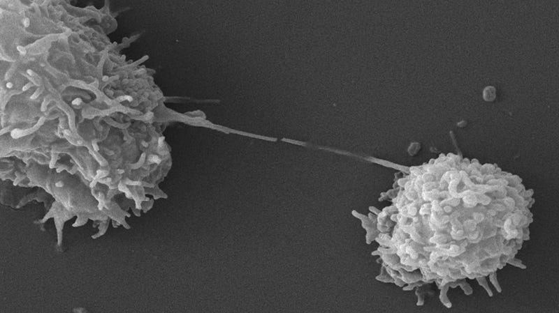 Two Acanthamoeba protozoa seen under a scanning electron microscope.