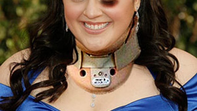Breaking Nikki Blonsky Injured Arrested In Brutal
